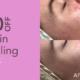 $50 off skin needling in January